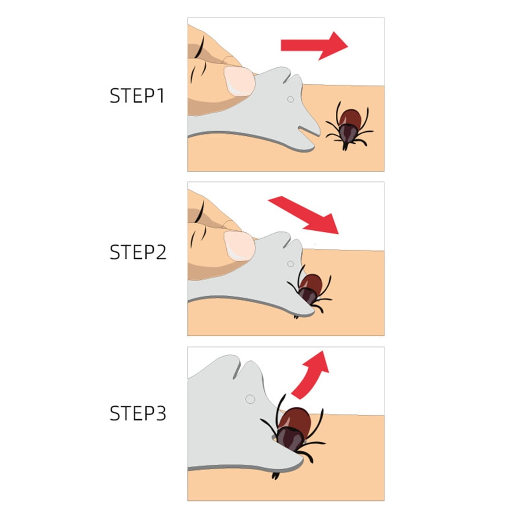 4Pcs Tick Remover Tick Remover Tools Tick Puller Removal for Dogs and Cats